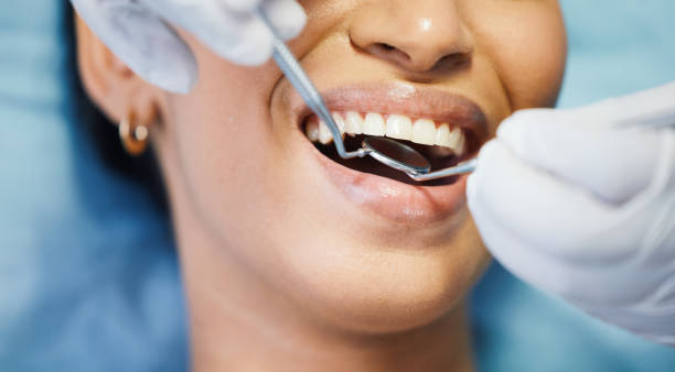 Best Emergency Denture Repair in Newport, RI