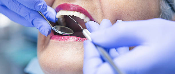 Trusted RI Emergency Dentist Experts